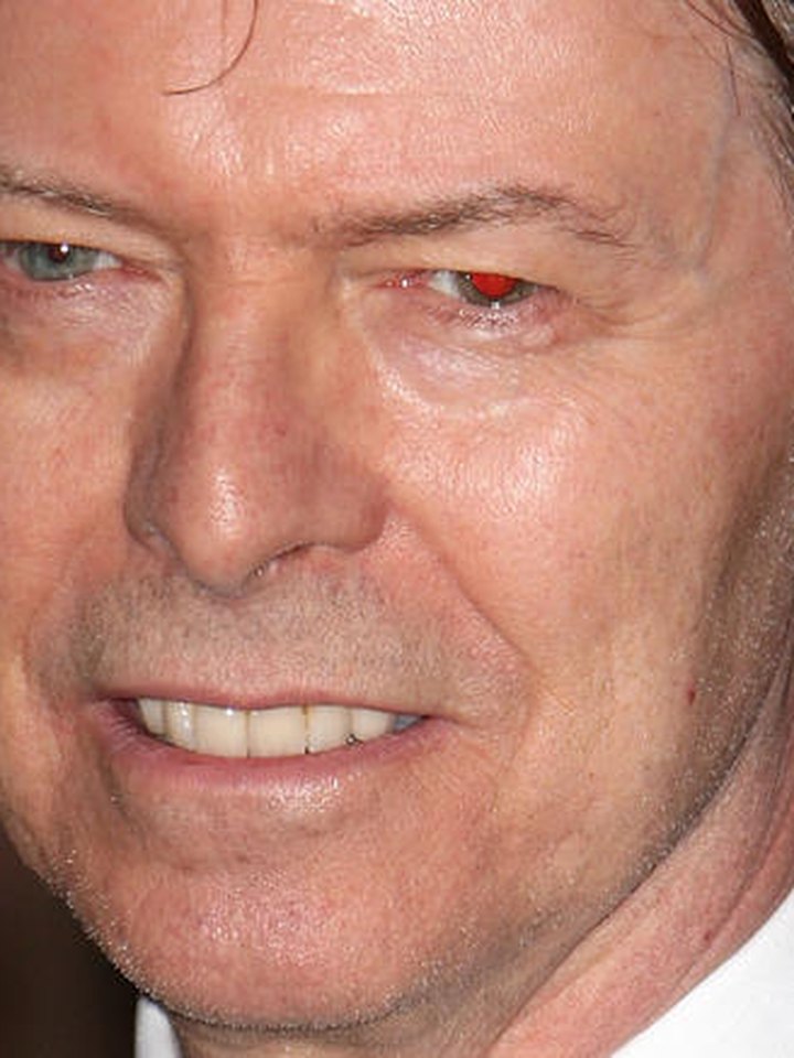 David Bowie en últimos años (2016)